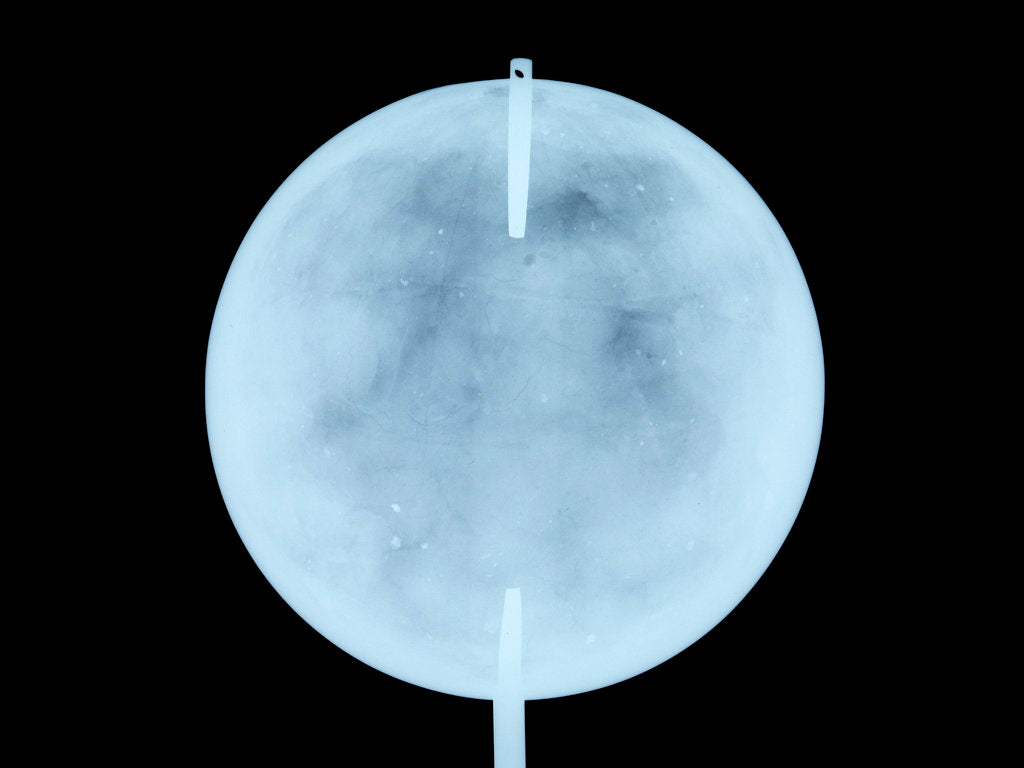 Detail of Globe x-ray by John Cary