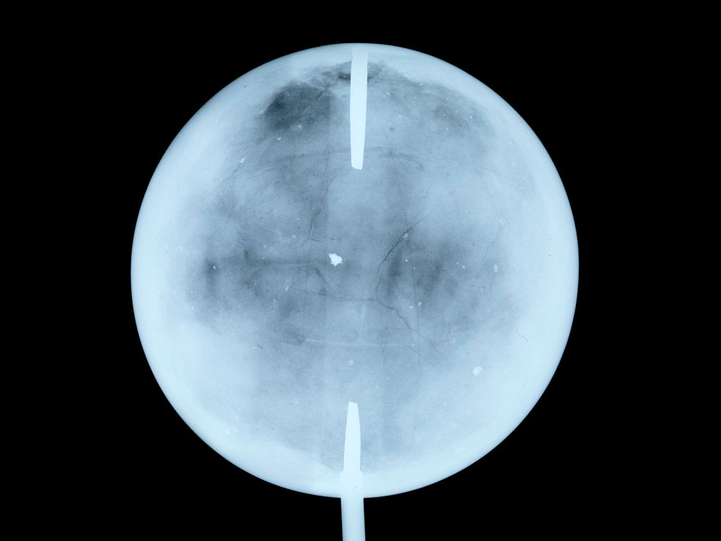 Detail of Globe x-ray by John Cary