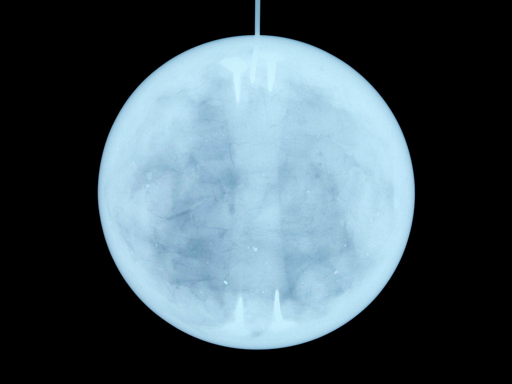Detail of Globe x-ray by John Miller
