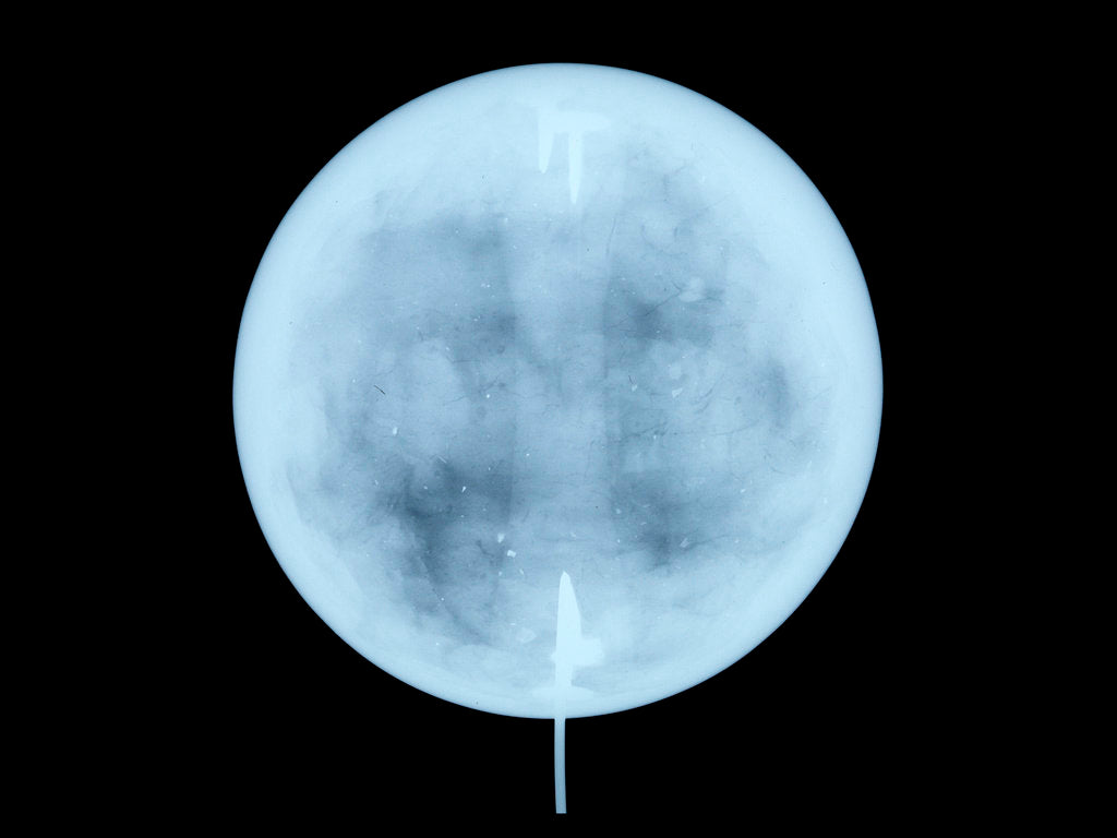 Detail of Globe x-ray by John Miller