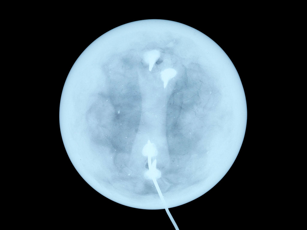 Detail of Globe x-ray by West