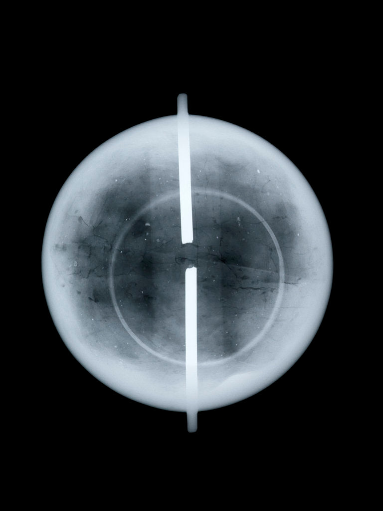 Detail of Globe x-ray by West