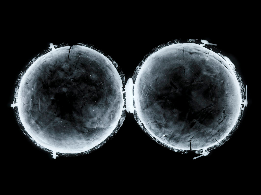 Detail of Globe x-ray by West