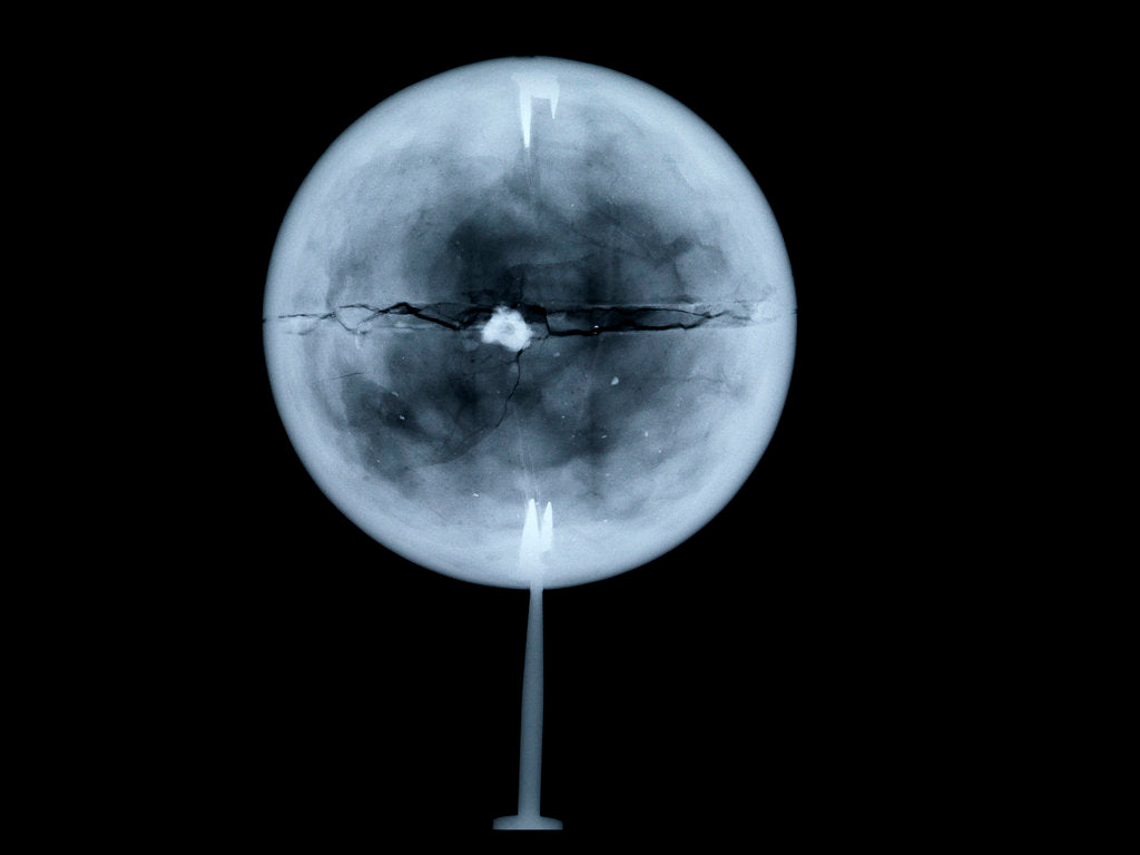Detail of Globe x-ray by Charles Price