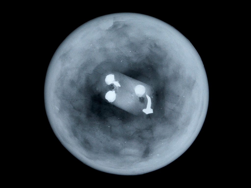 Detail of Globe x-ray by Charles Price