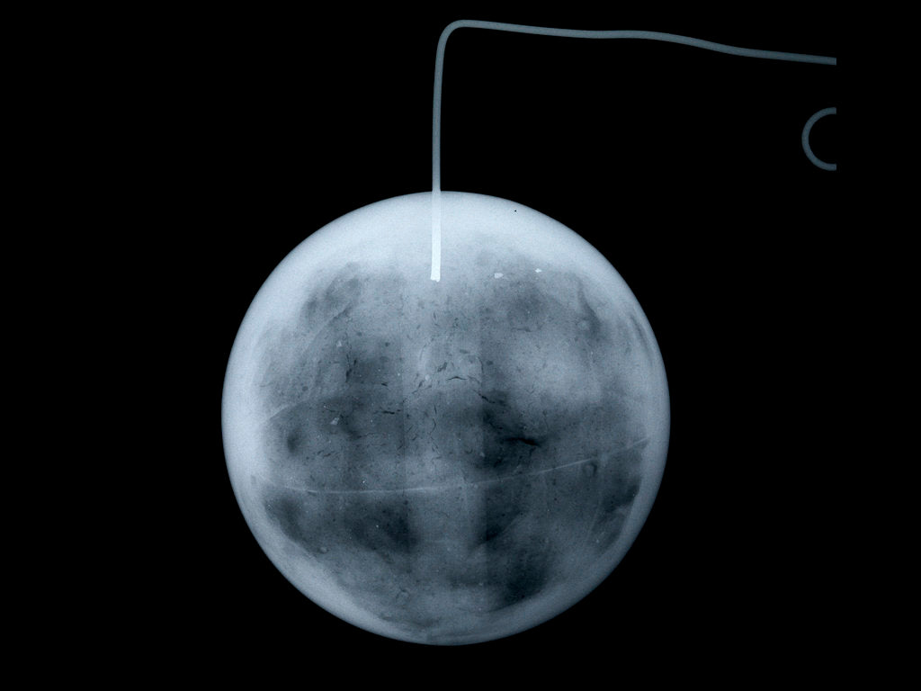 Detail of Globe x-ray by George Adams