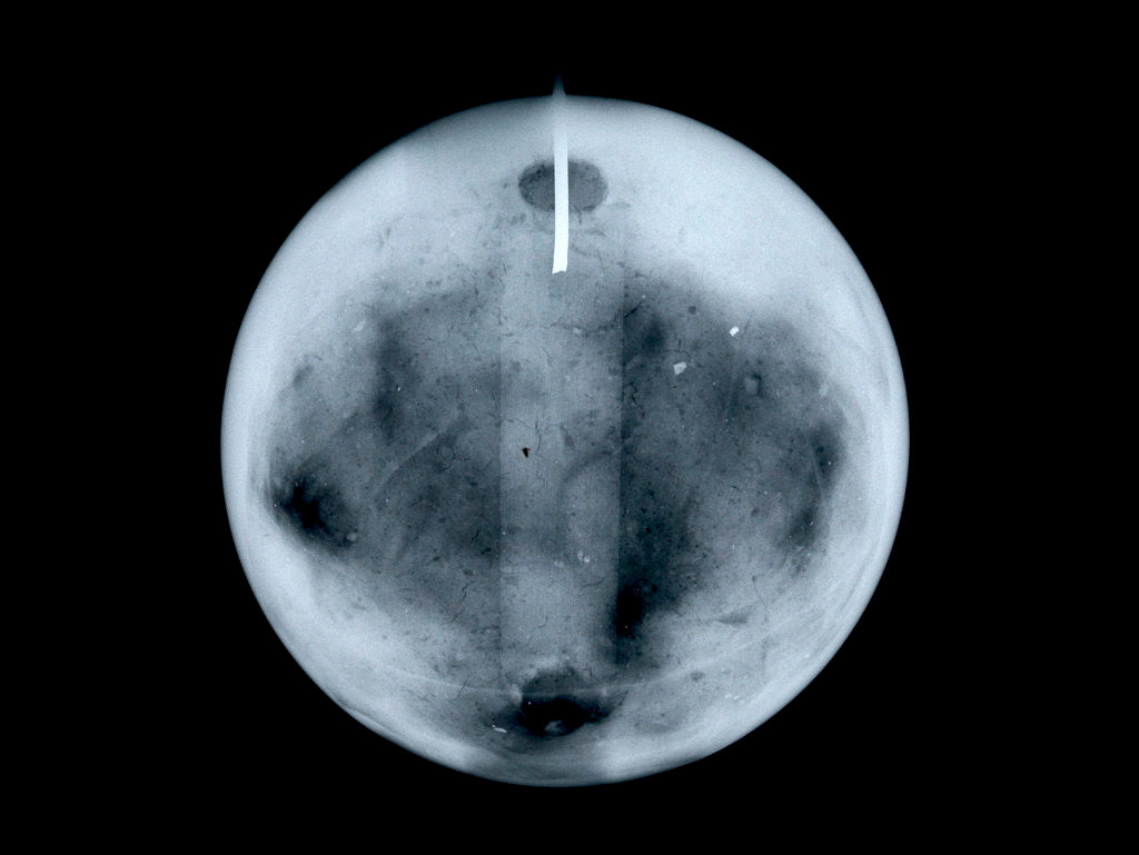 Detail of Globe x-ray by George Adams