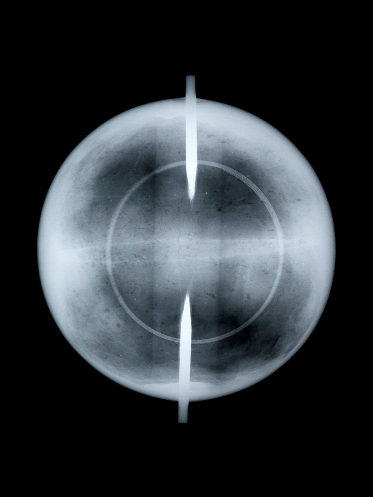 Detail of Globe x-ray by Nicolas Lane