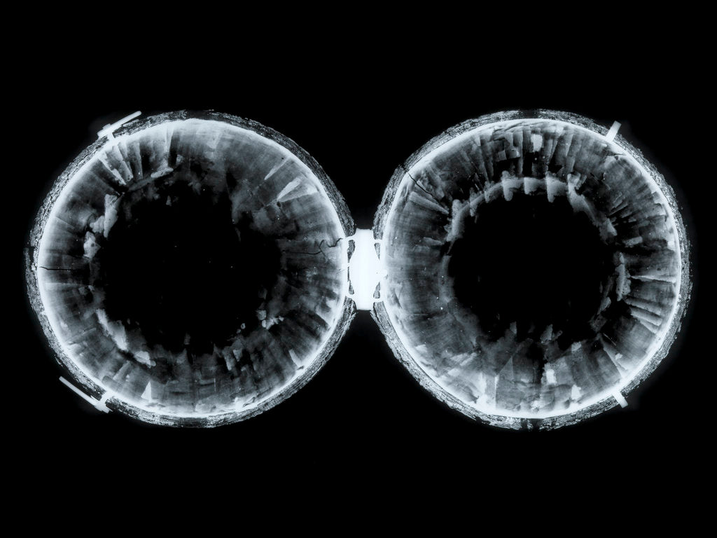 Detail of Globe x-ray by Nicolas Lane