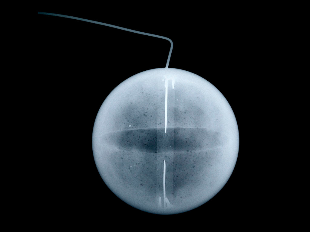 Detail of Globe x-ray by William Palmer