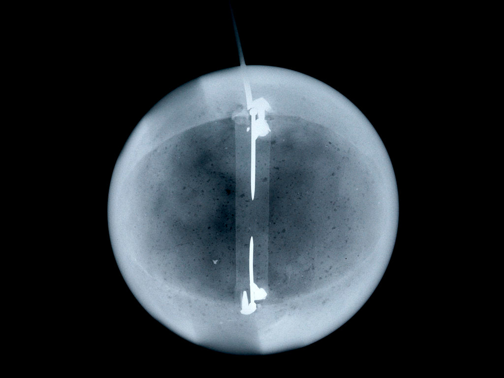 Detail of Globe x-ray by William Palmer