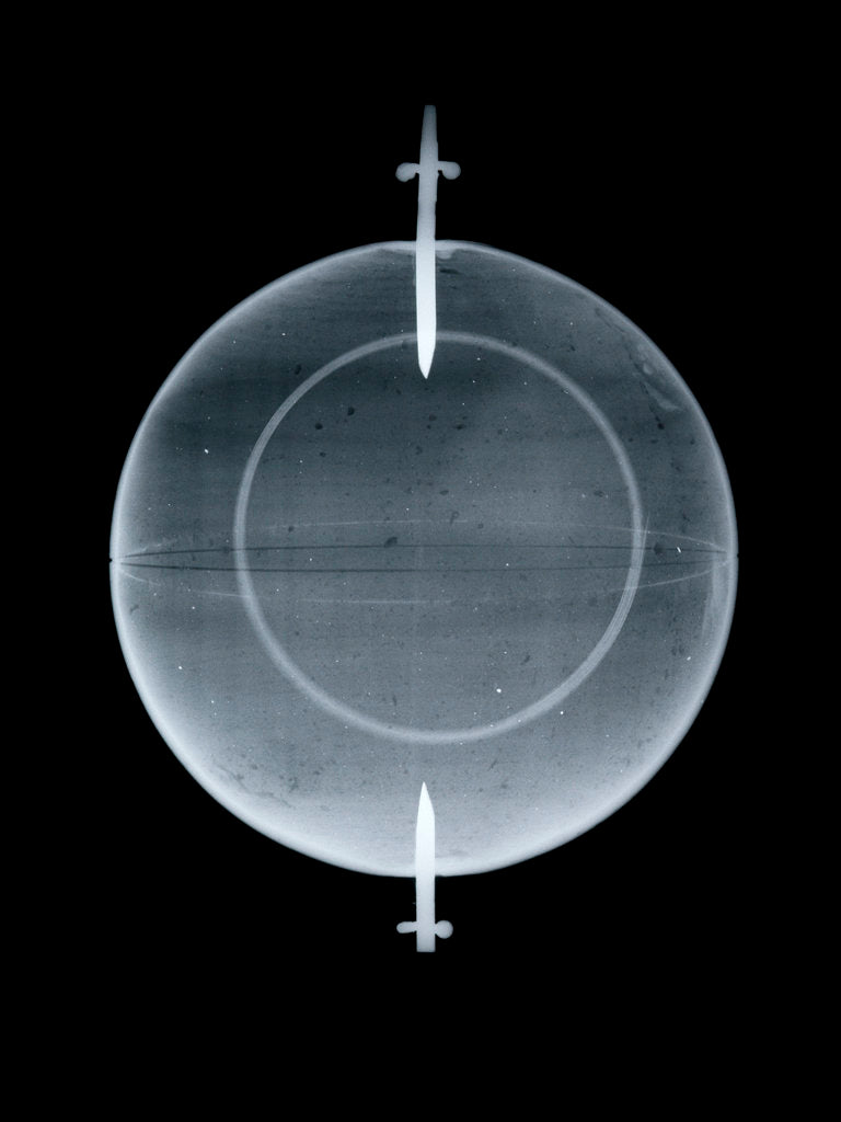 Detail of Globe x-ray by Jean Fortin