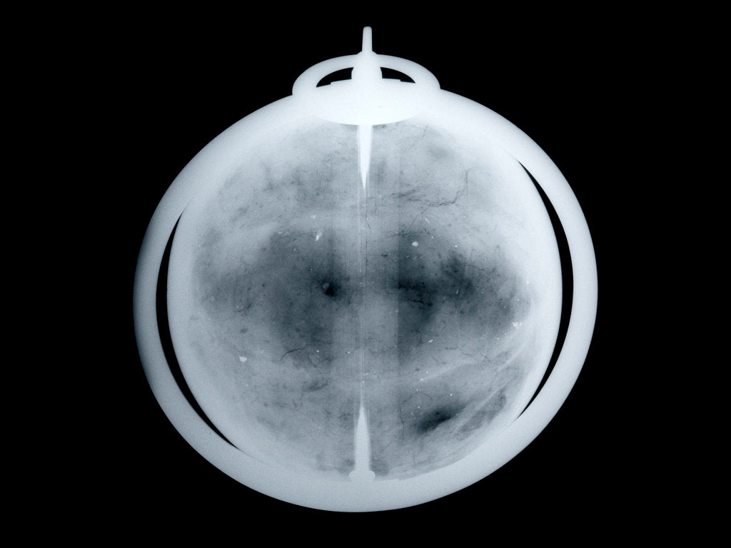 Detail of Globe x-ray by John Senex