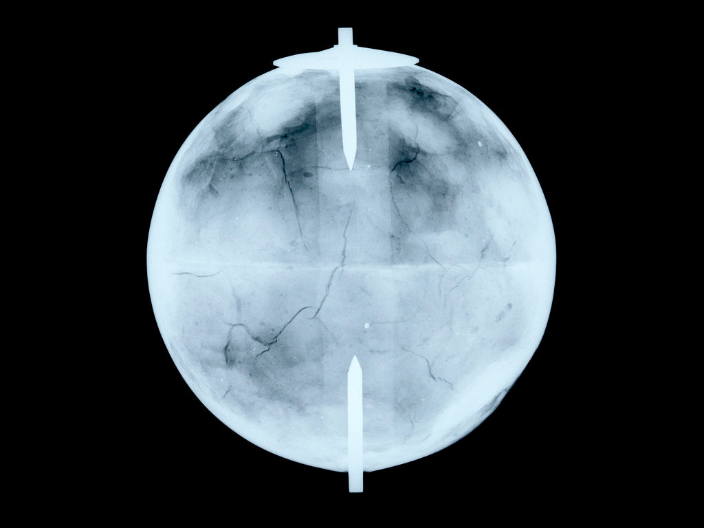 Detail of Globe x-ray by Dudley Adams