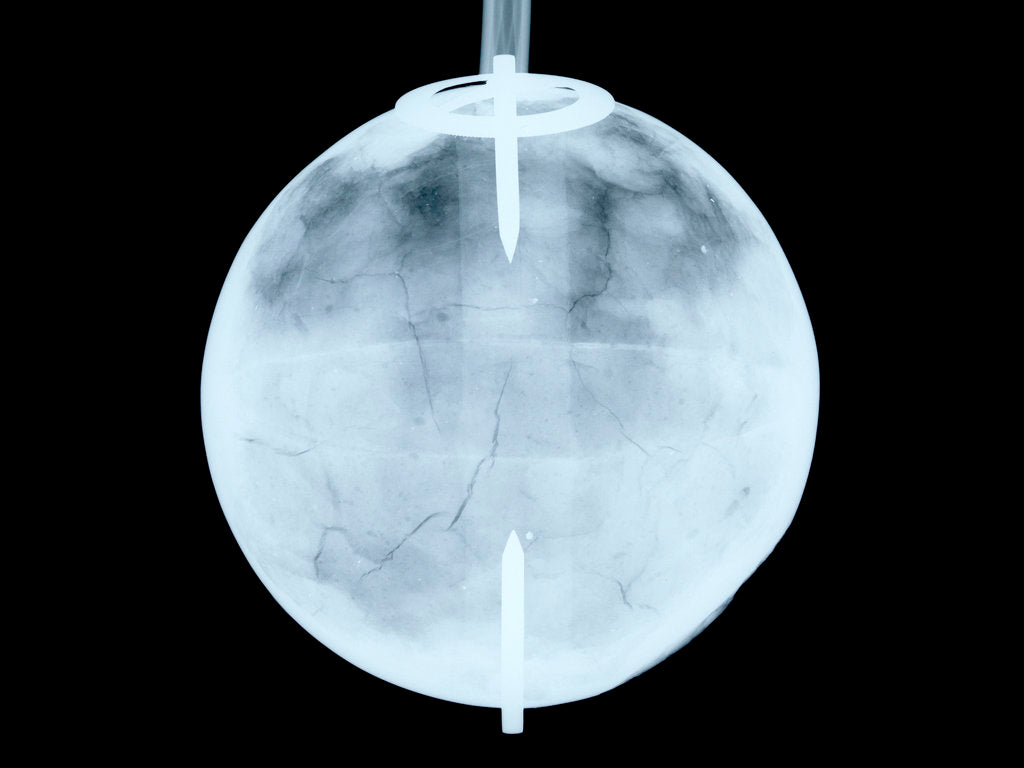 Detail of Globe x-ray by Dudley Adams