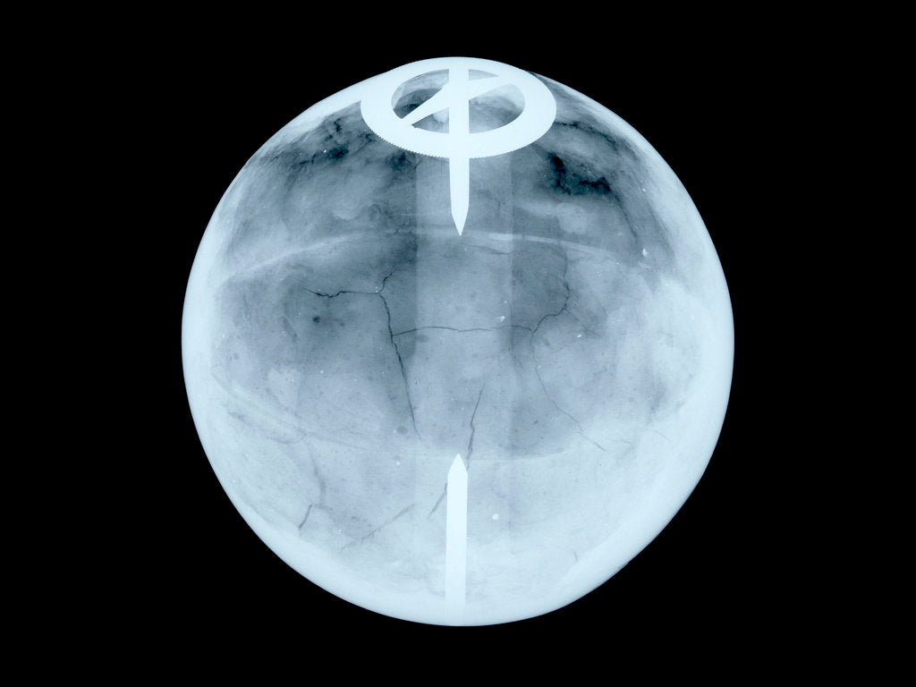 Detail of Globe x-ray by Dudley Adams