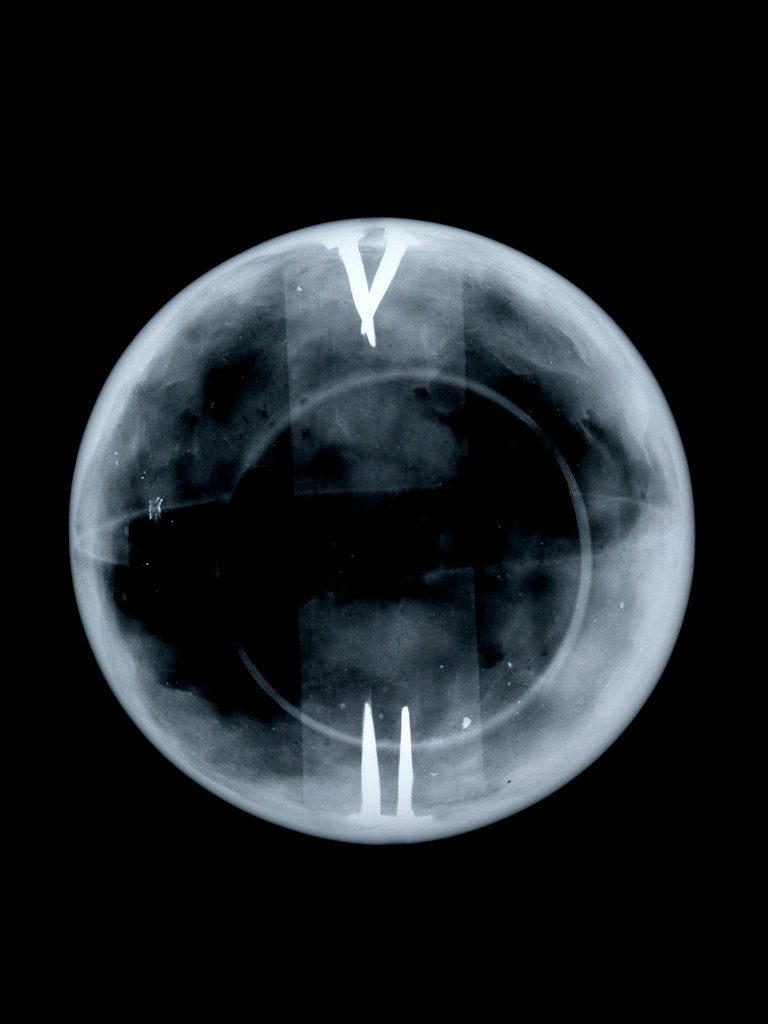 Detail of Globe x-ray by Richard Cushee