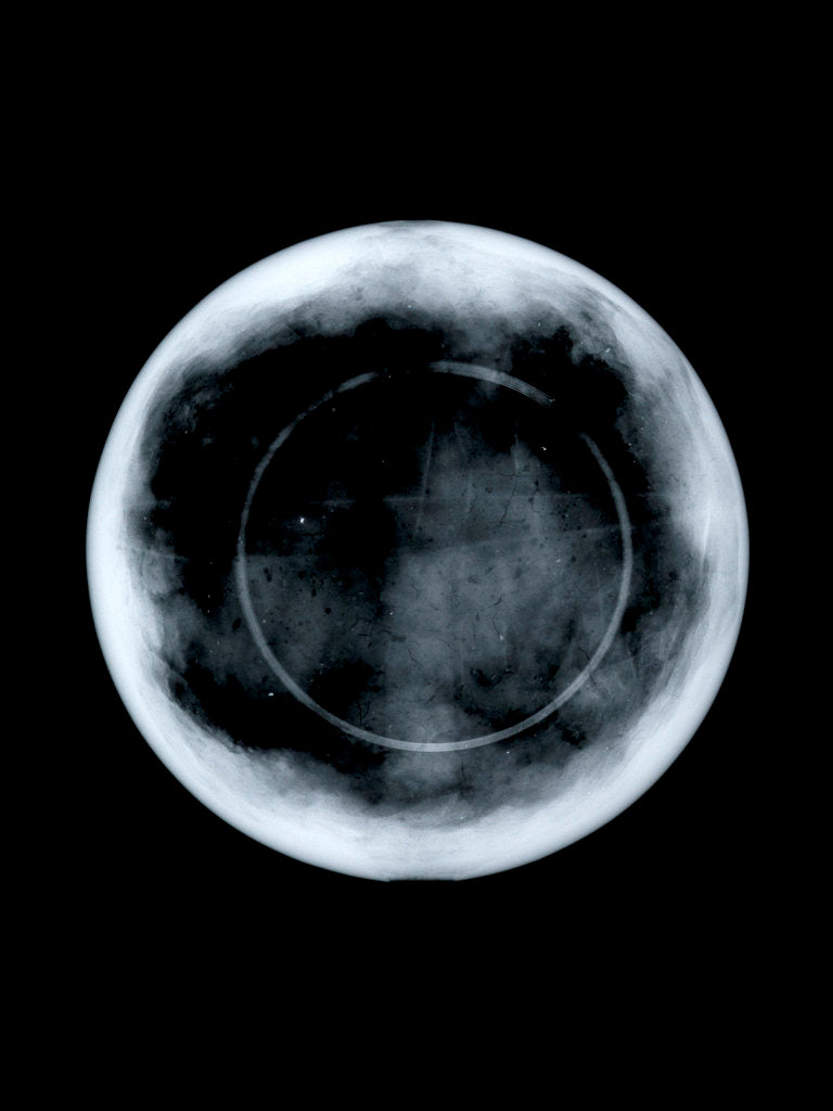 Detail of Globe x-ray by George Adams