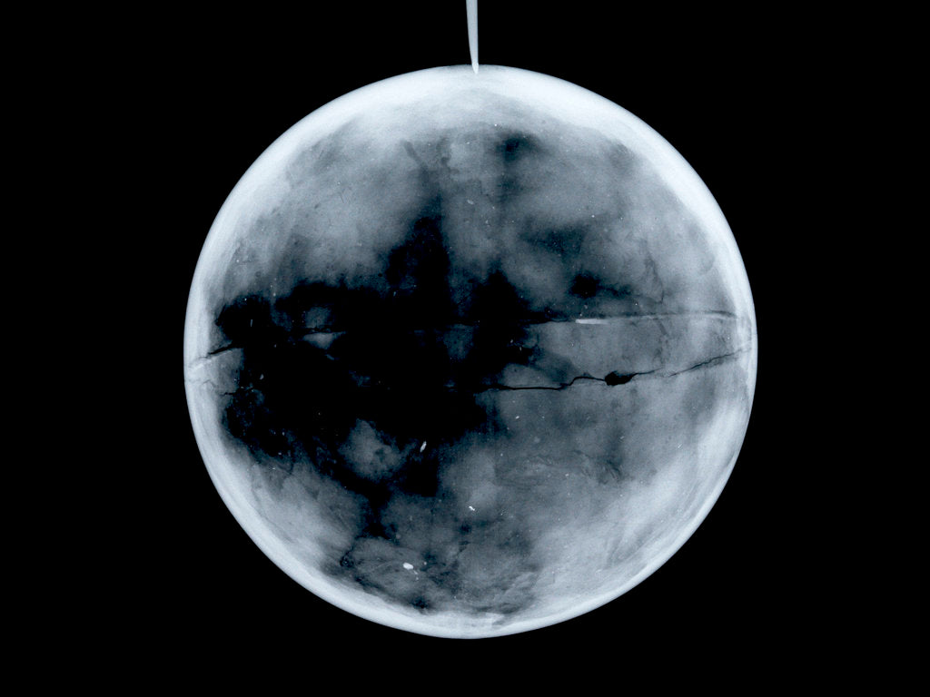 Detail of Globe x-ray by James Ferguson