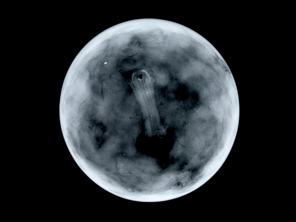 Detail of Globe x-ray by James Ferguson