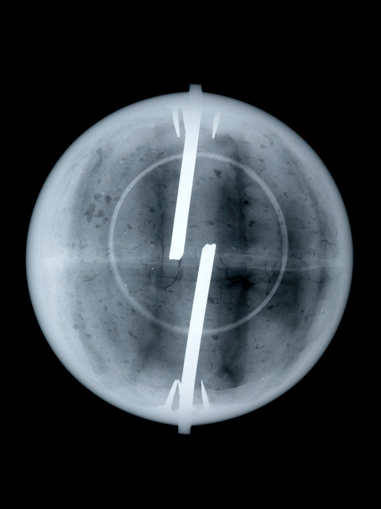 Detail of Globe x-ray by Newton & Co.
