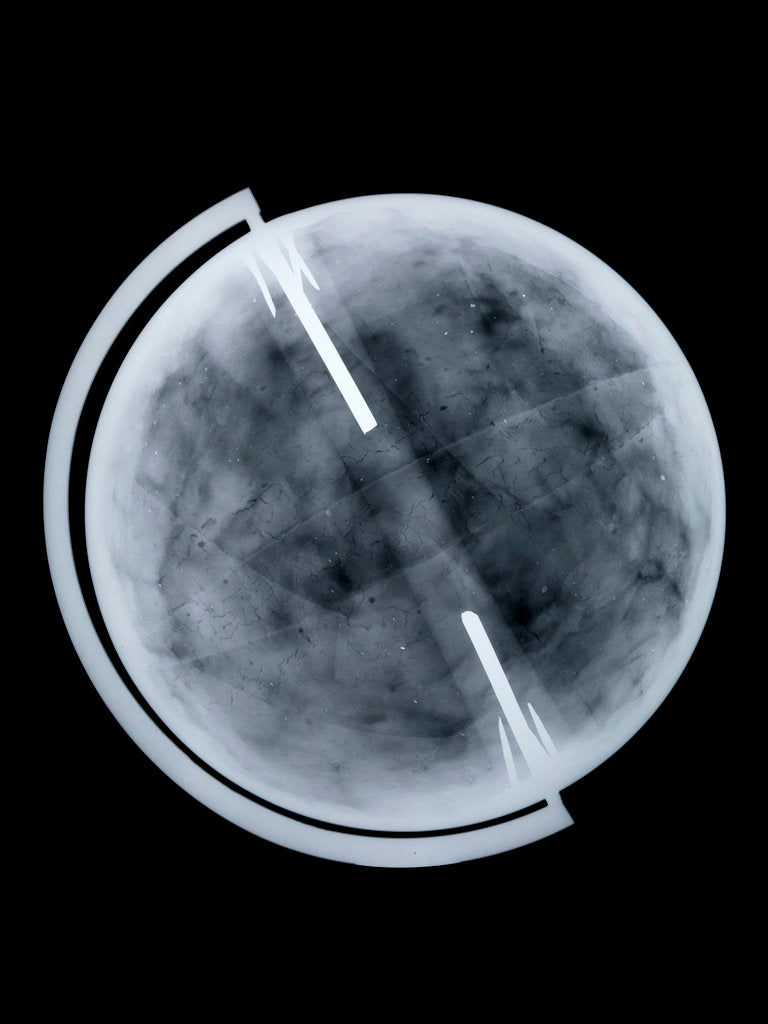 Detail of Globe x-ray by Newton Son & Berry