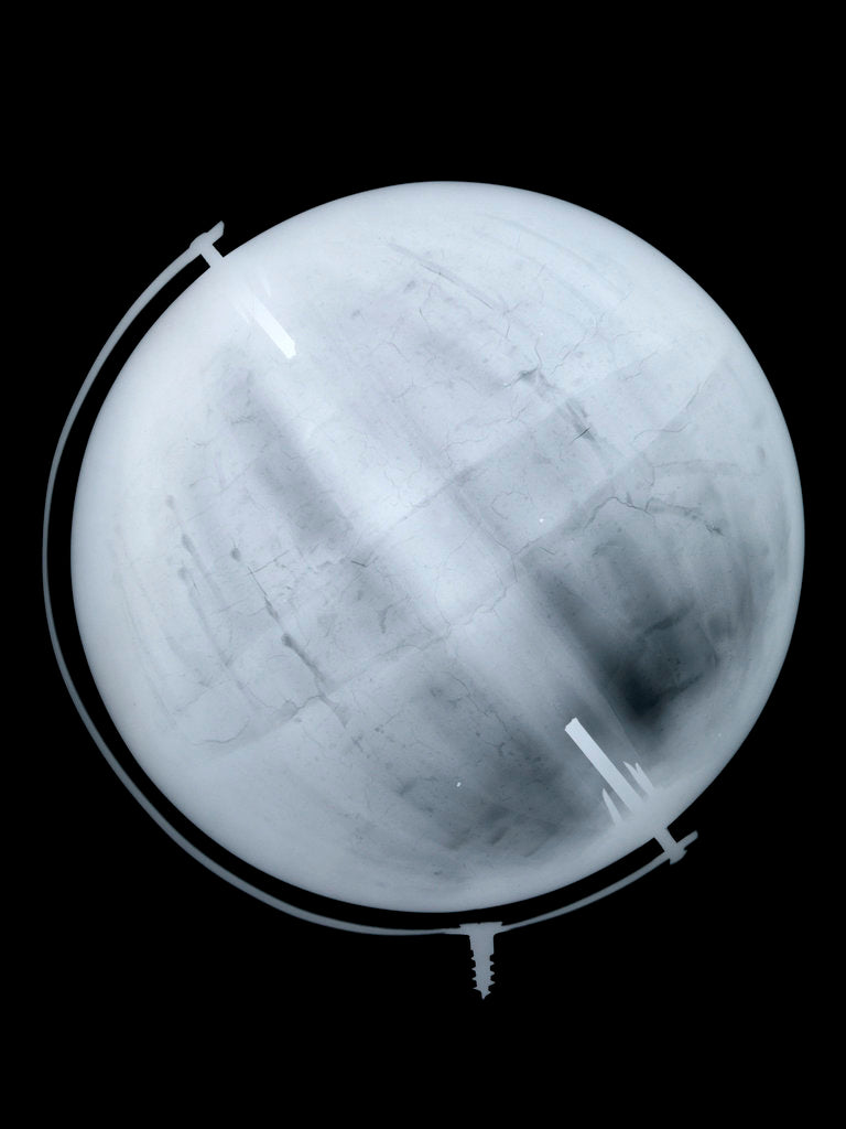 Detail of Globe x-ray by William Johnston
