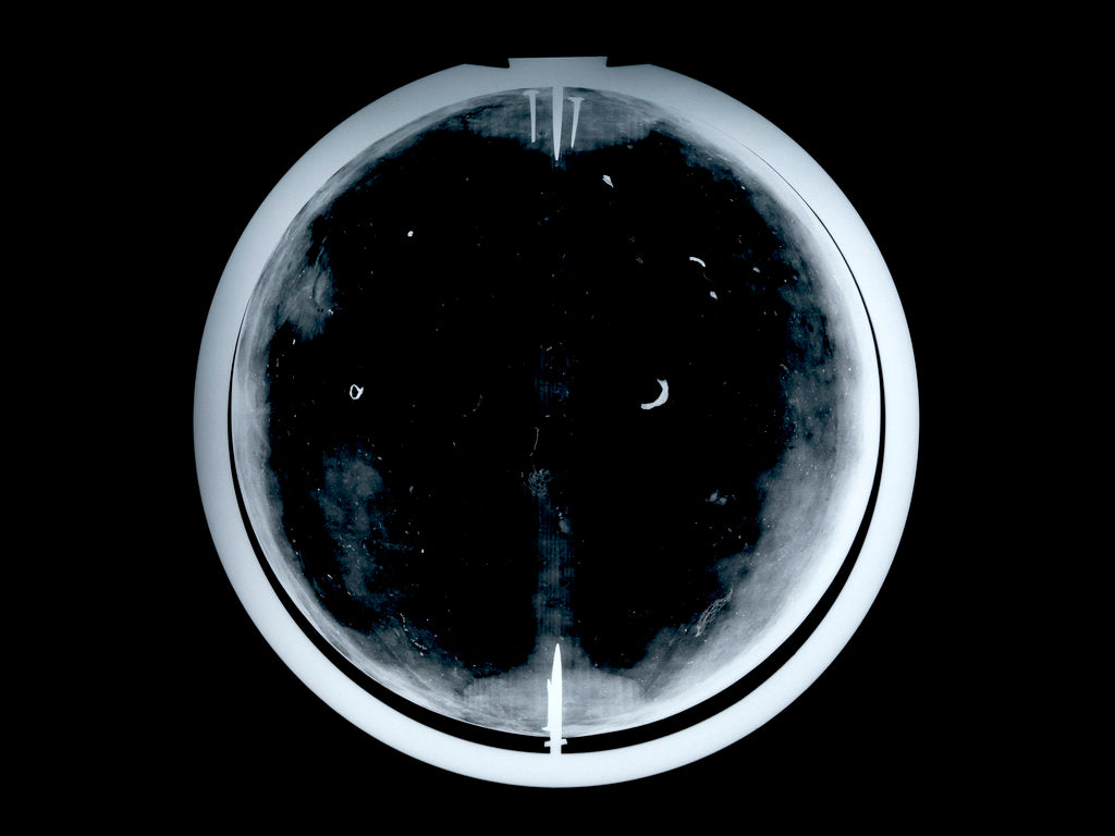 Detail of Globe x-ray by Johann Gabriel Doppelmayr