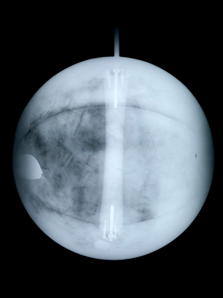 Detail of Globe x-ray by Benjamin Martin