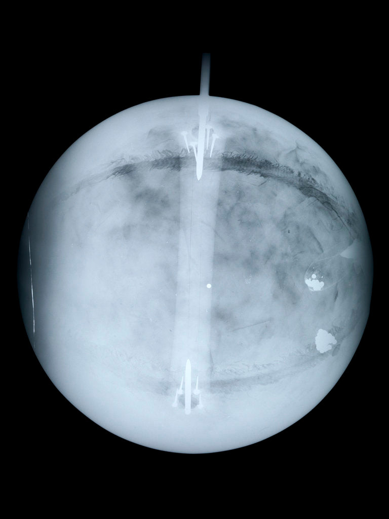 Detail of Globe x-ray by Benjamin Martin