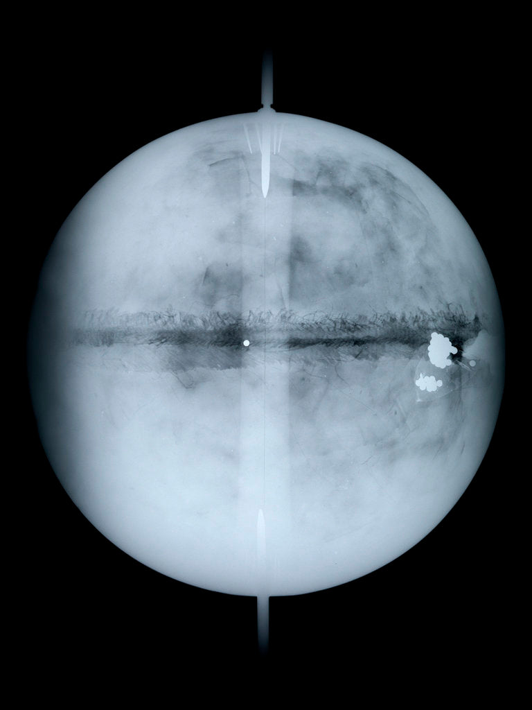 Detail of Globe x-ray by Benjamin Martin