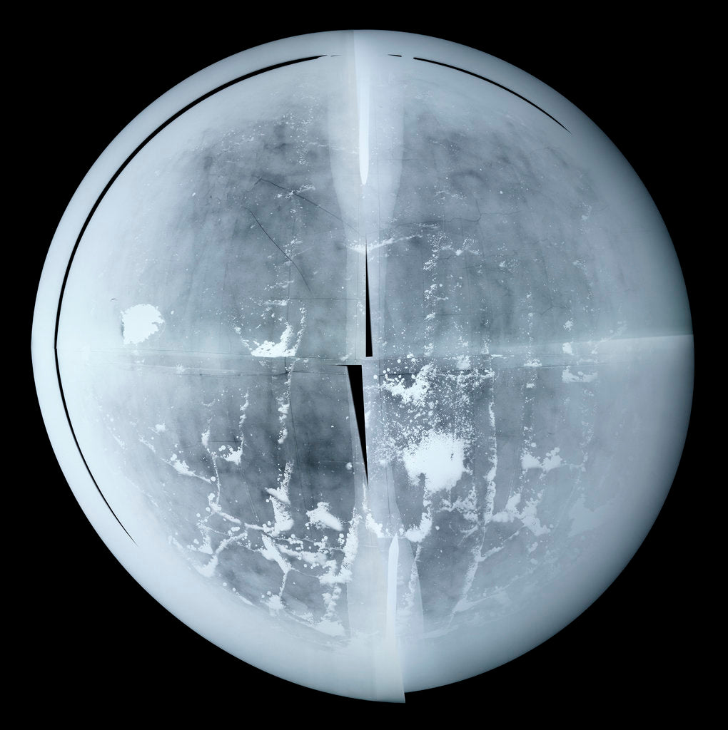 Detail of Globe x-ray by Newton Son & Berry