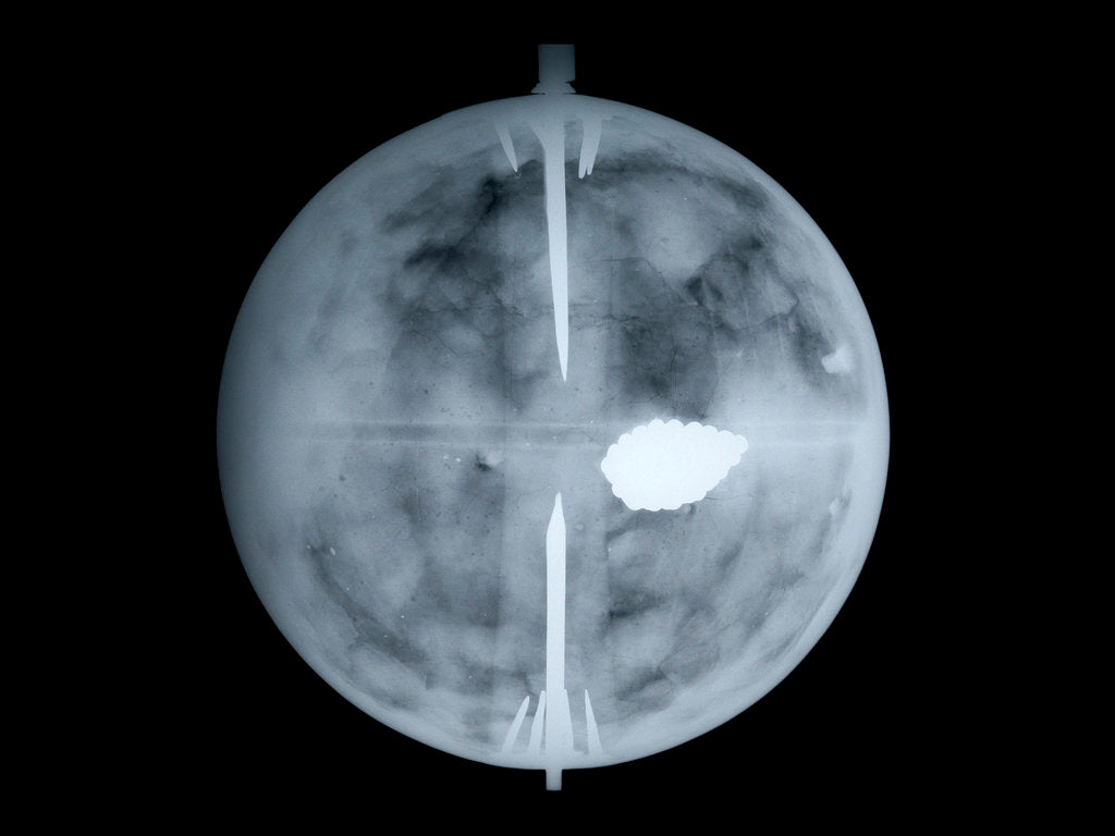 Detail of Globe x-ray by Nathaniel Hill