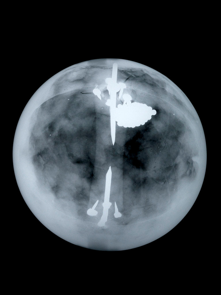 Detail of Globe x-ray by Nathaniel Hill