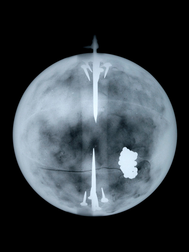 Detail of Globe x-ray by Nathaniel Hill
