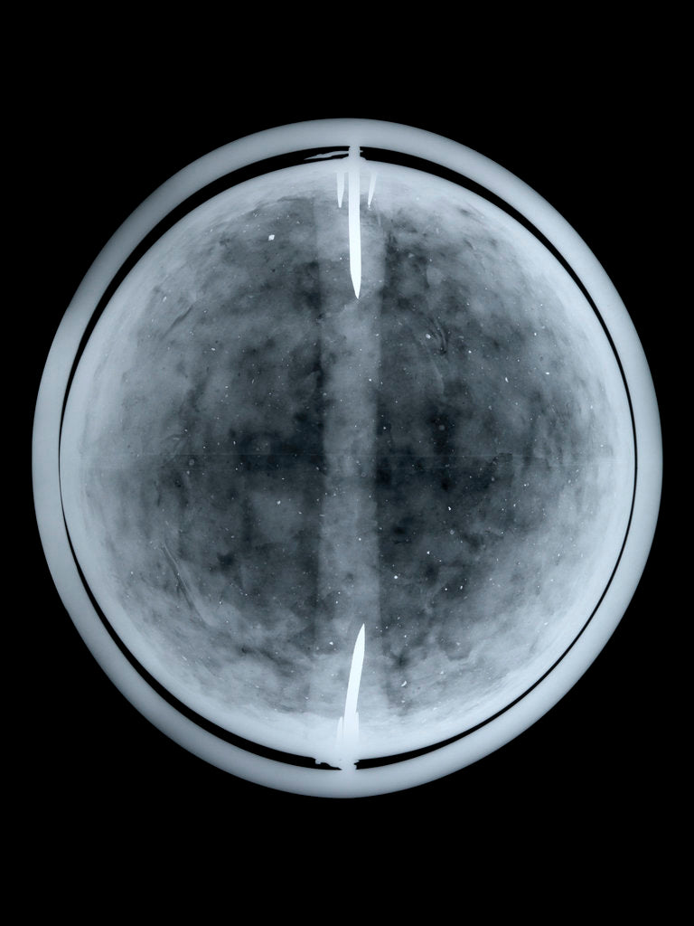 Detail of Globe x-ray by William Bardin