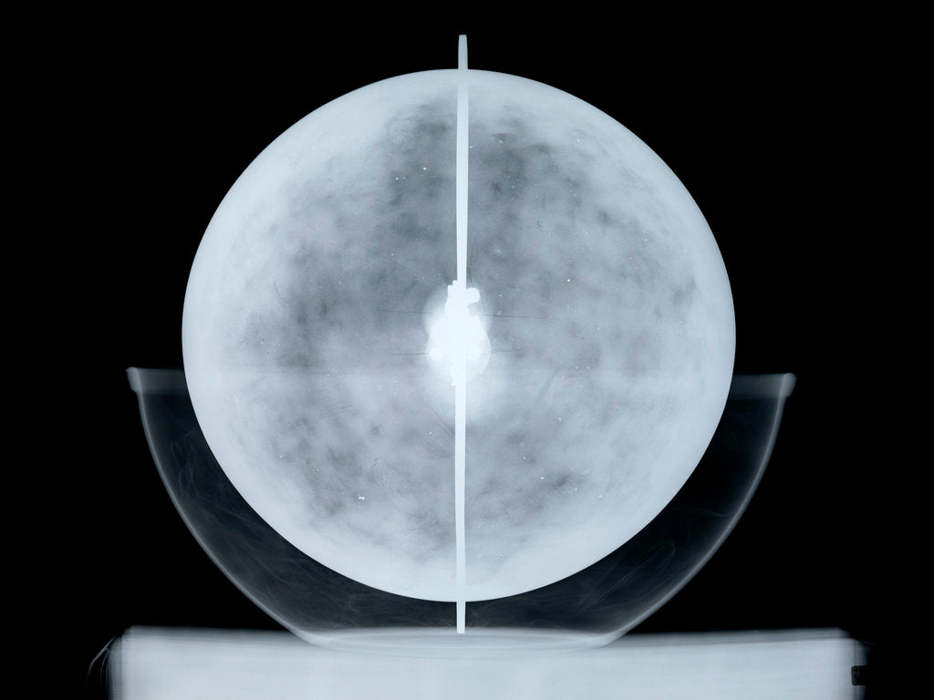 Detail of Globe x-ray by William Bardin