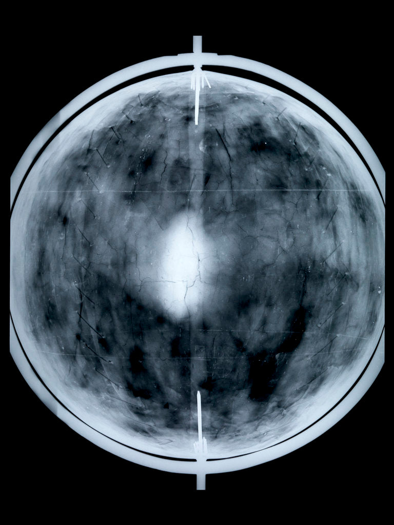 Detail of Globe x-ray by Jacob Floris van Langren