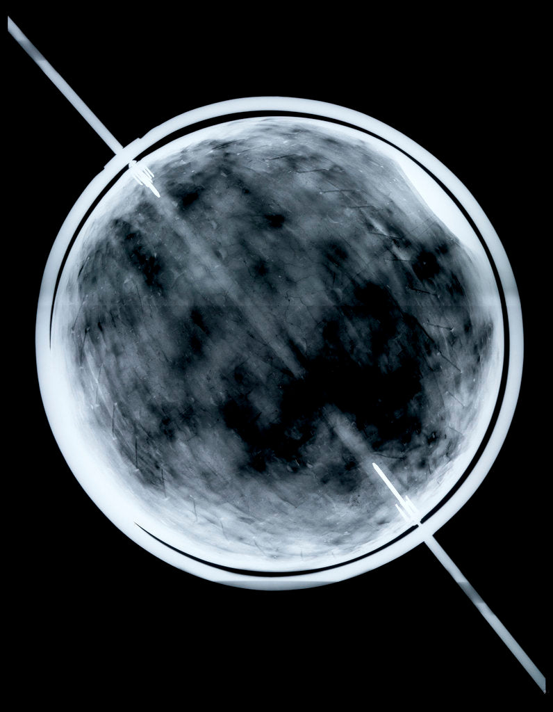 Detail of Globe x-ray by Jacob Floris van Langren