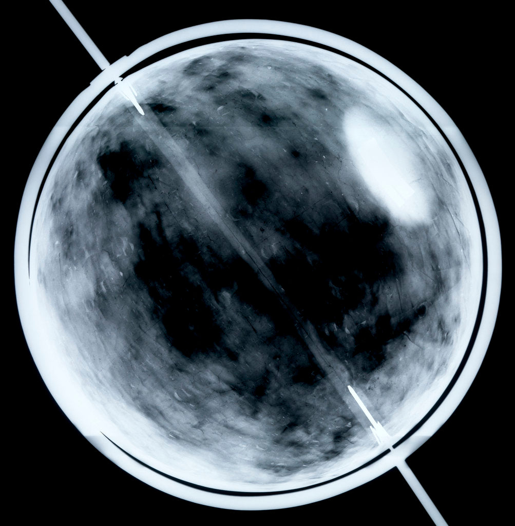 Detail of Globe x-ray by Jacob Floris van Langren