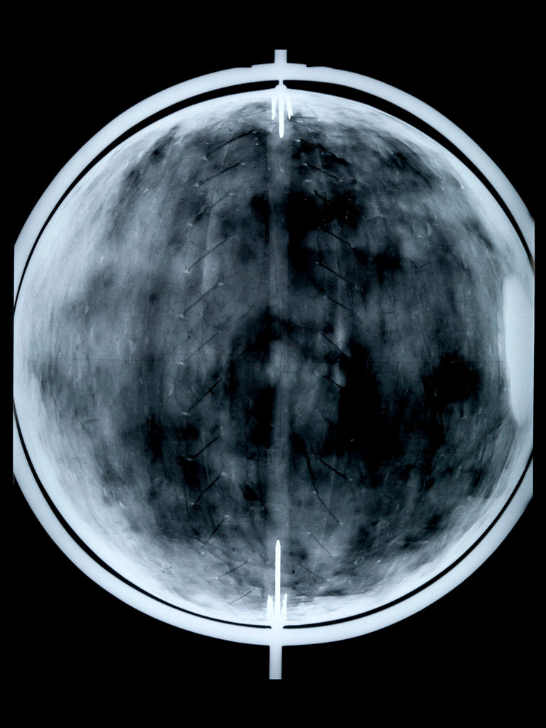 Detail of Globe x-ray by Jacob Floris van Langren
