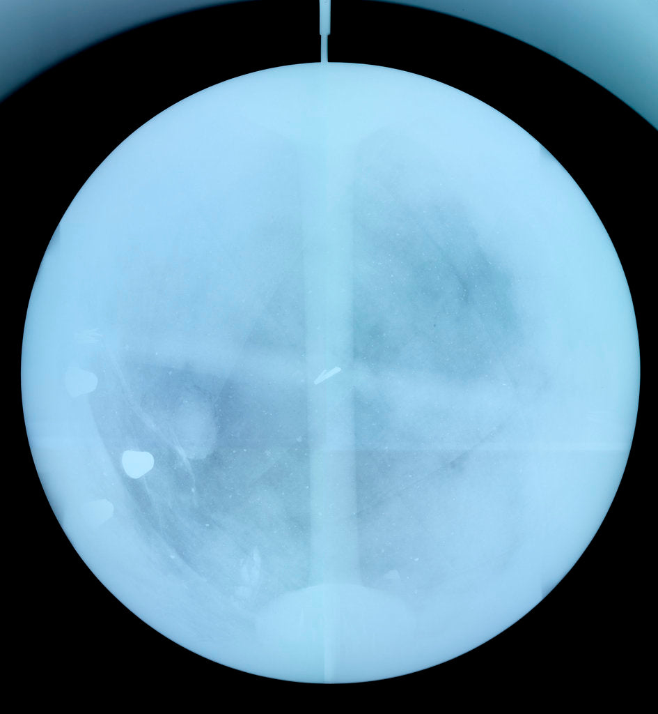 Detail of Globe x-ray by Gerard Valk