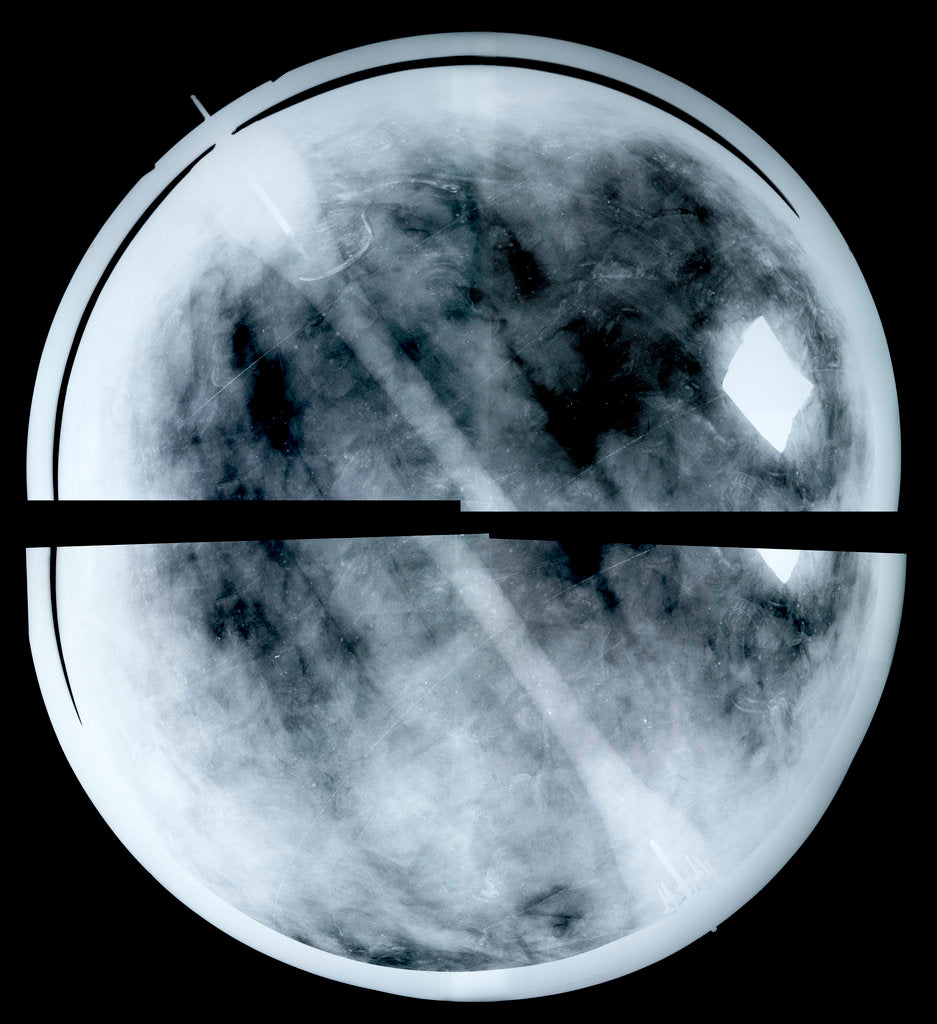 Detail of Globe x-ray by Arnold Floris van Langren