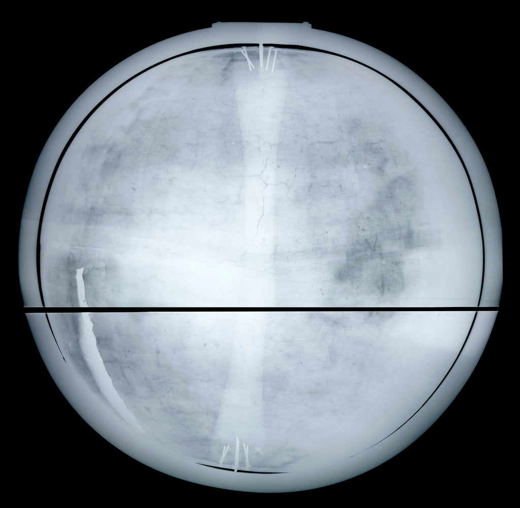 Detail of Globe x-ray by Jean Antoine Nollet