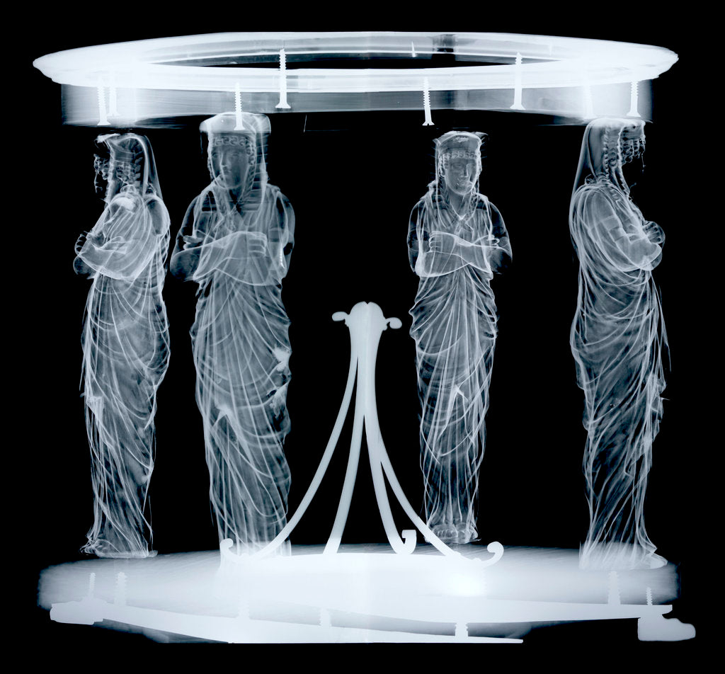 Detail of Globe x-ray by Hyacinthe Langlois