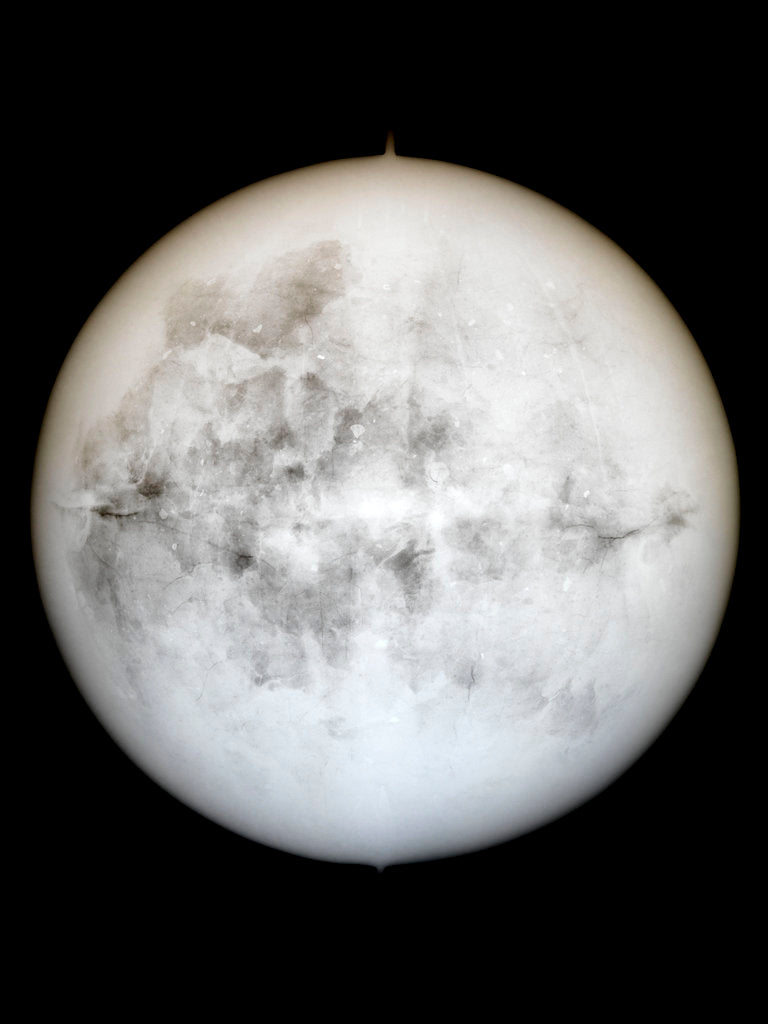 Detail of Globe x-ray by Hyacinthe Langlois