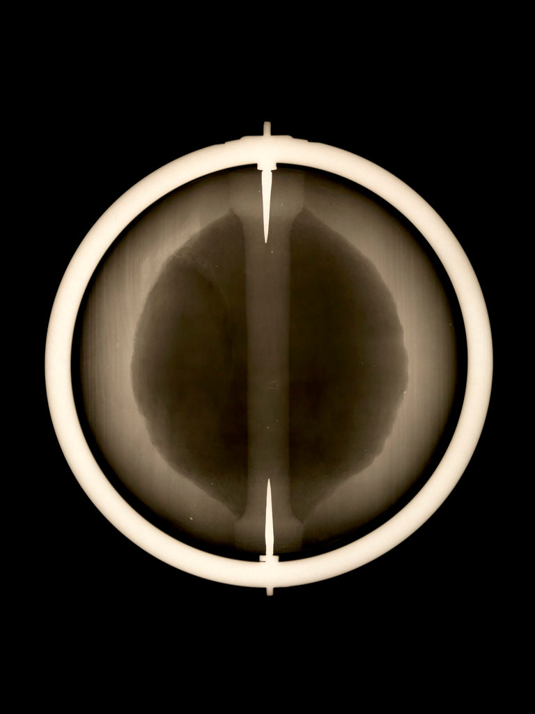 Detail of Globe x-ray by Joannes Oterschaden