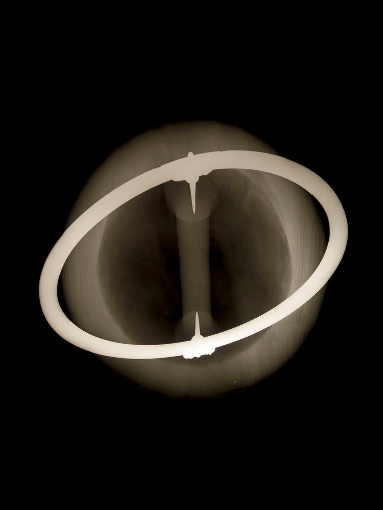 Detail of Globe x-ray by Joannes Oterschaden
