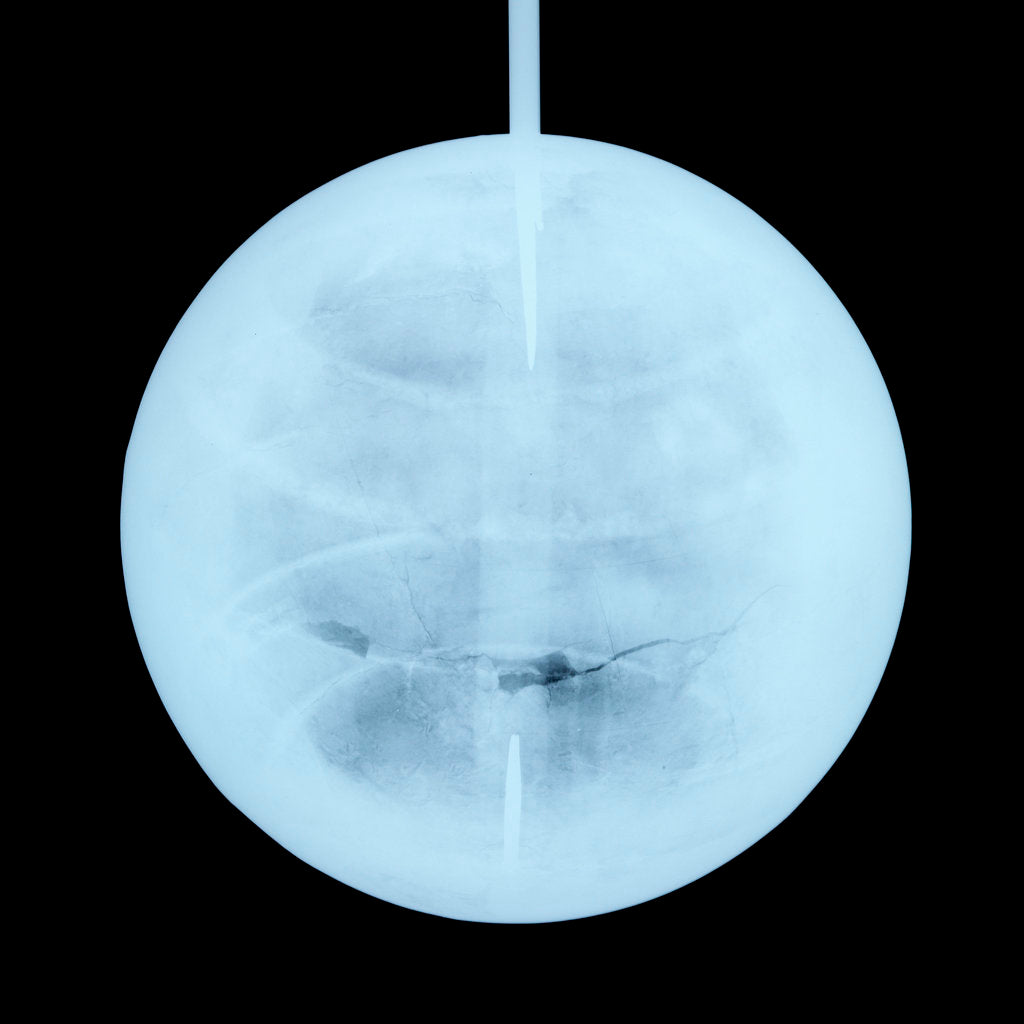 Detail of Globe x-ray by Peter Anich