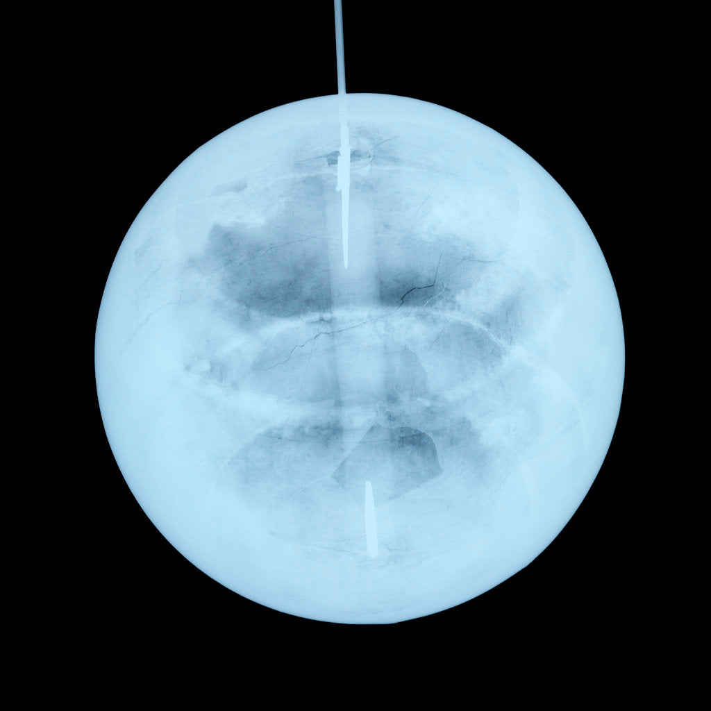 Detail of Globe x-ray by Peter Anich